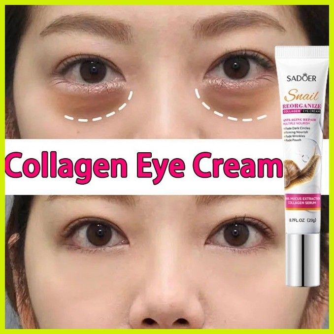 Anti-Wrinkle And Dark Circles Eye Cream