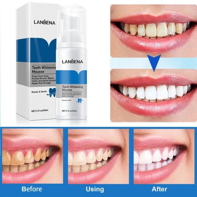 Lanbena teeth whitening mousse