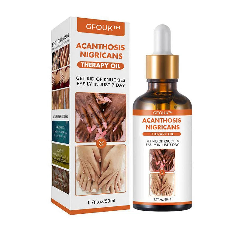 Acanthosis Nigricans Therapy Oil